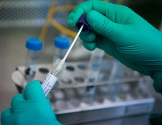 Bộ Y tế quy định mức thanh toán tối đa giá dịch vụ xét nghiệm